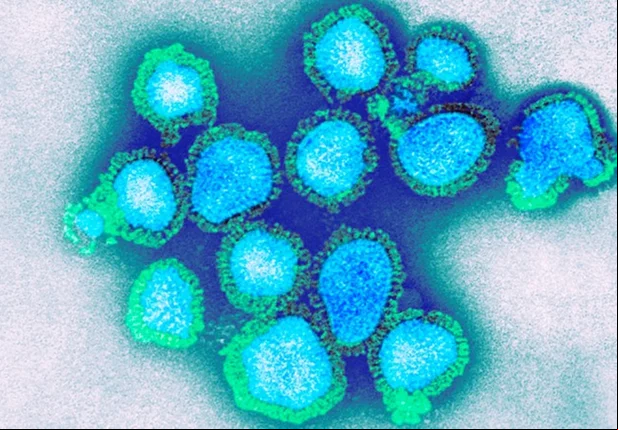 Vírus Influenza H3N2