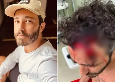 Ator Thiago Rodrigues perdeu parte do couro cabeludo
