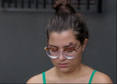 Victória Soares mostra marcas da agressão sofrida