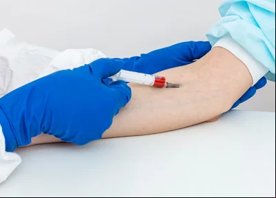 Novo exame de sangue que ajuda a detectar o Alzheimer chega ao Brasil
