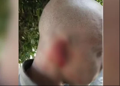 PM teve parte da orelha arrancada em abordagem policial