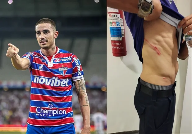 Thiago Galhardo chuta funcionário do Ceará