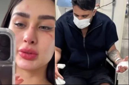 Miss Amazonas acusa ex-namorado de agressão