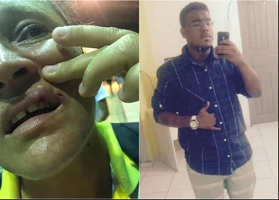 Eliete Fontenele foi agredida por Rodrigo Quixada