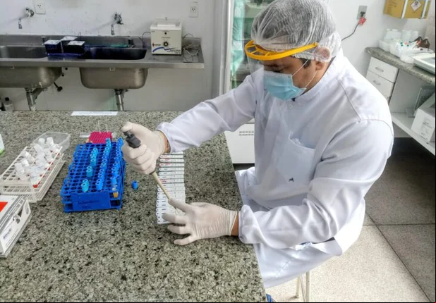 Laboratório do HGV já realizou mais de mil exames para covid-19