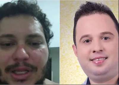 Prefeito Erivelto Barros é acusado de agredir professor em bar