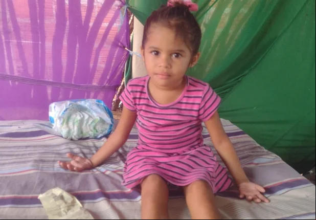 Família de criança que teve corpo queimado no Piauí pede ajuda